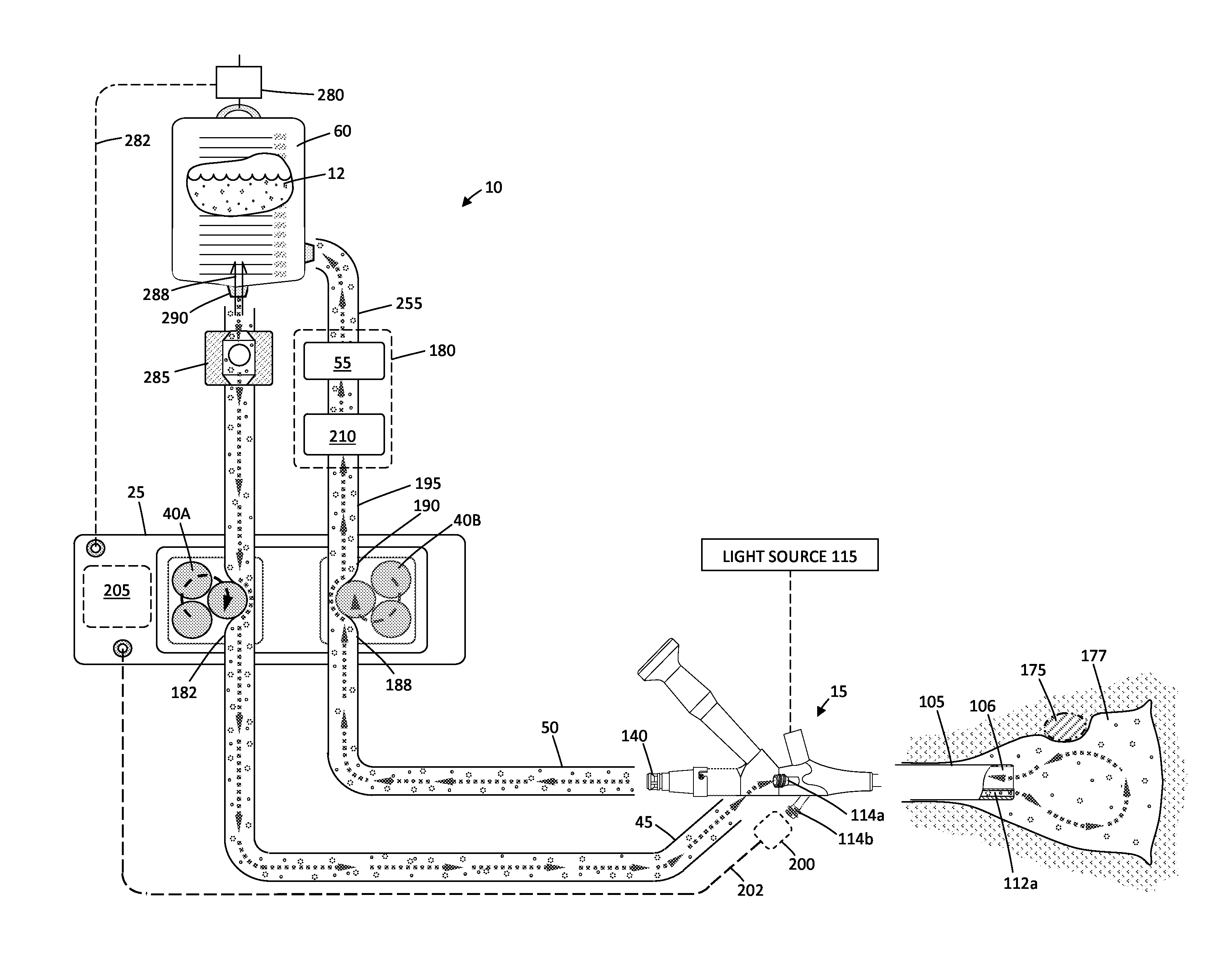 Fluid management system and methods