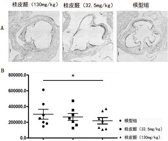 Application of cinnamaldehyde in preparing medicine for treating atherosclerosis