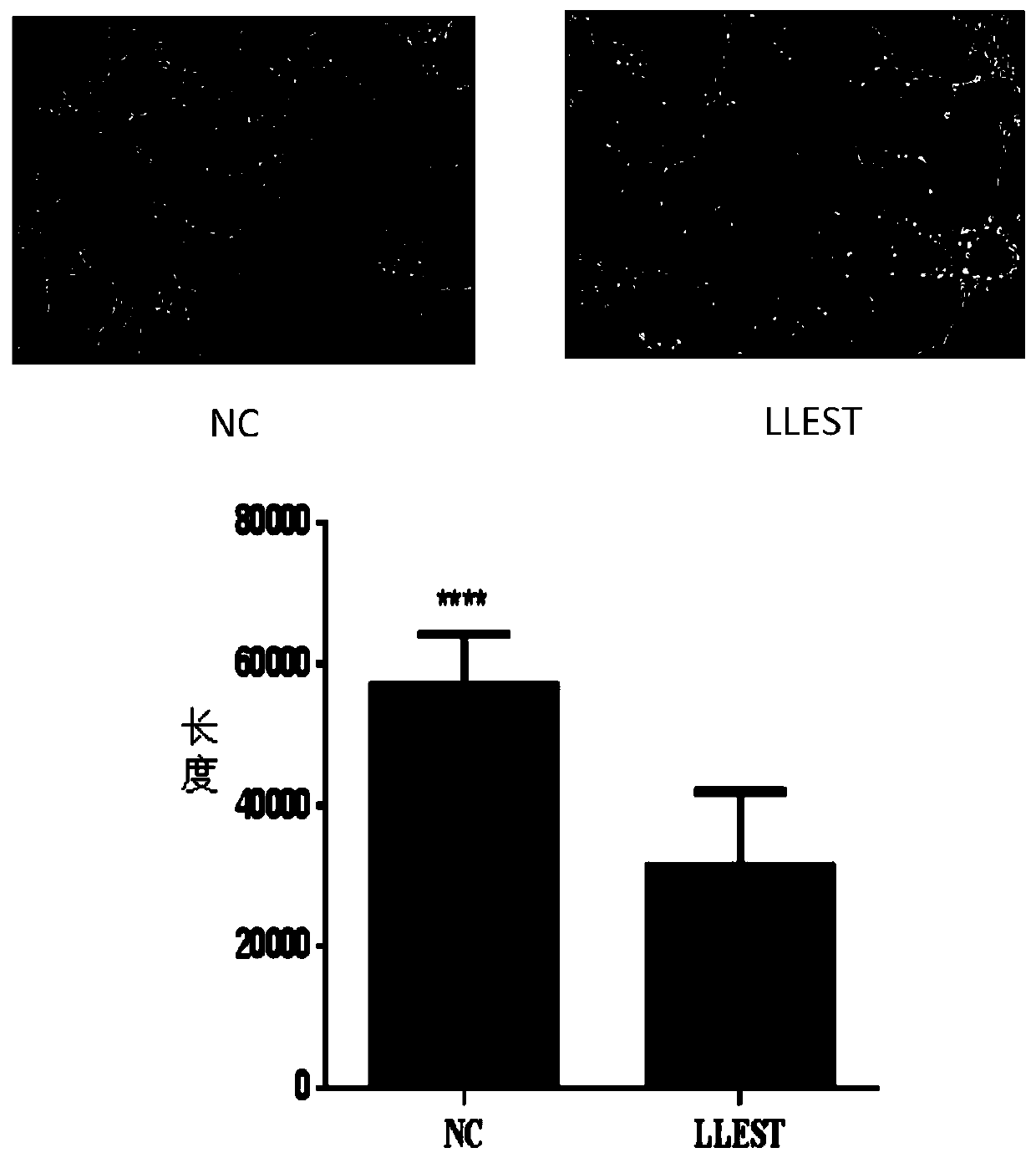 Application of long-chain non-coding RNA in preparation of tumor angiogenesis inhibitor
