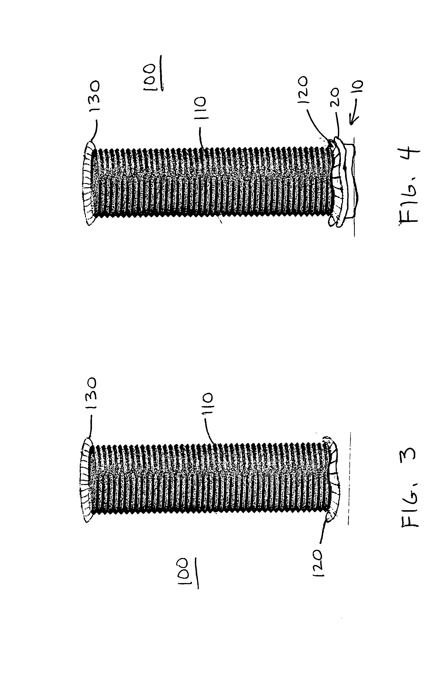 Synthetic blood vessel grafts