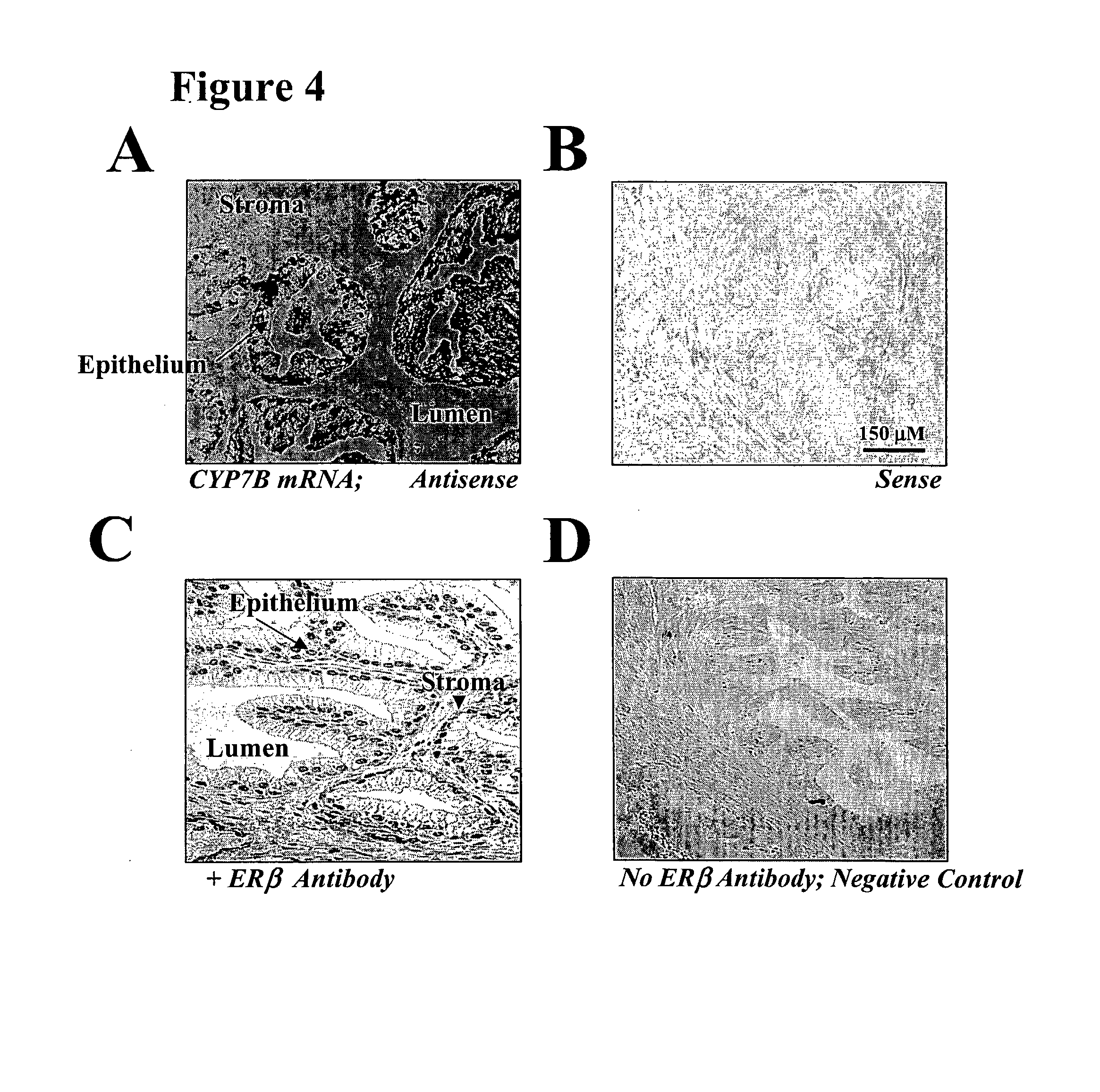 Uses of Erss Modulators