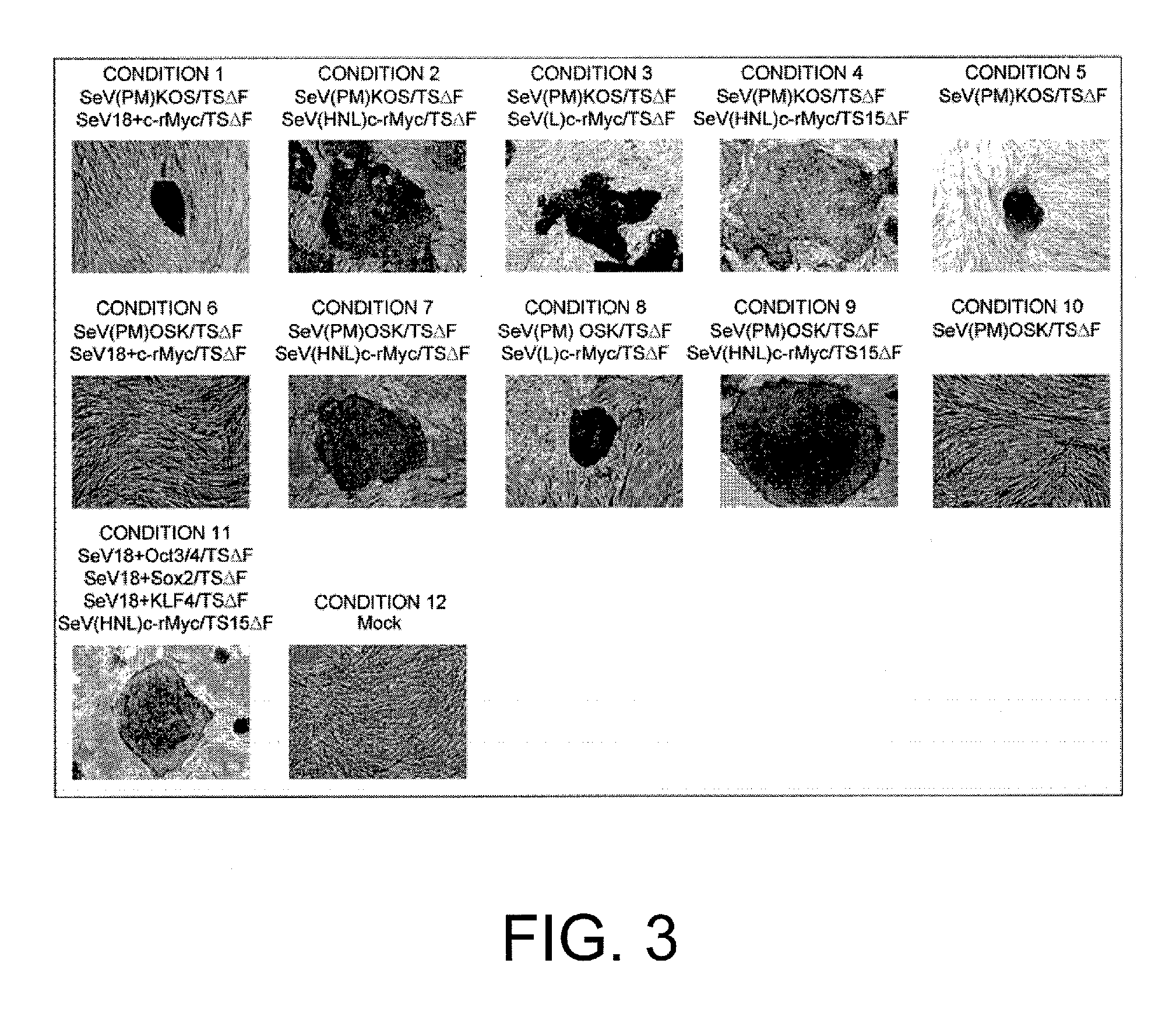 Composition for inducing pluripotent stem cell, and use thereof