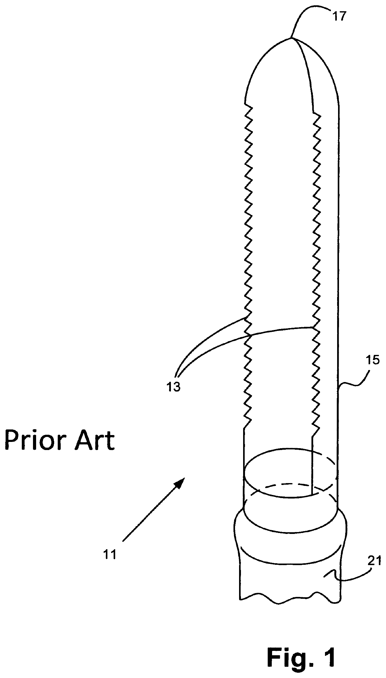 Fruit and vegetable coring system