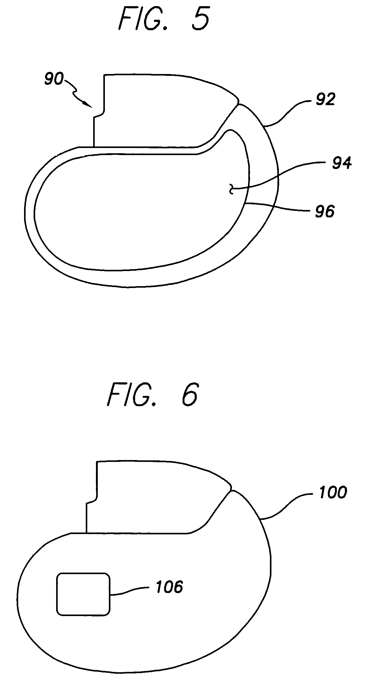 Implantable medical device having a casing providing high-speed telemetry