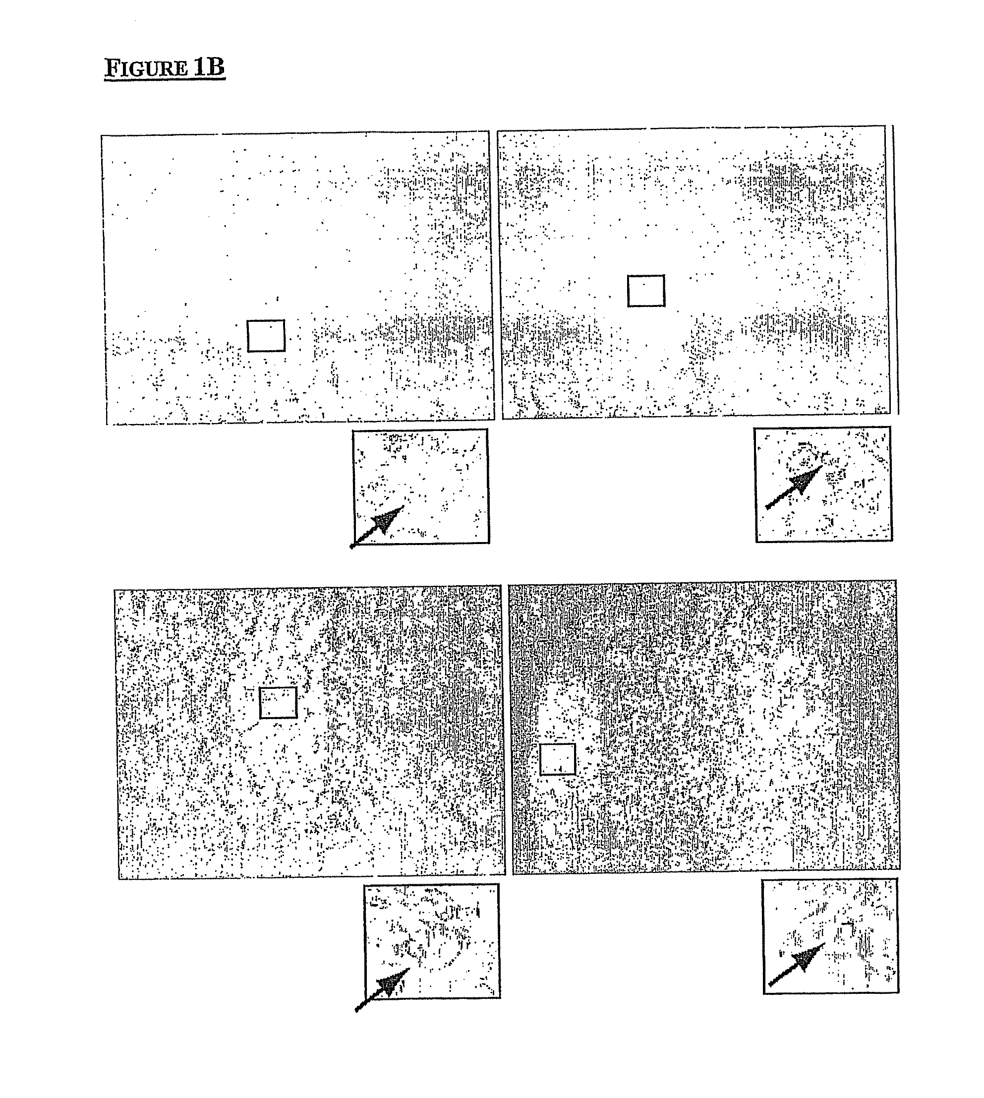 Method of deriving progenitor cell line