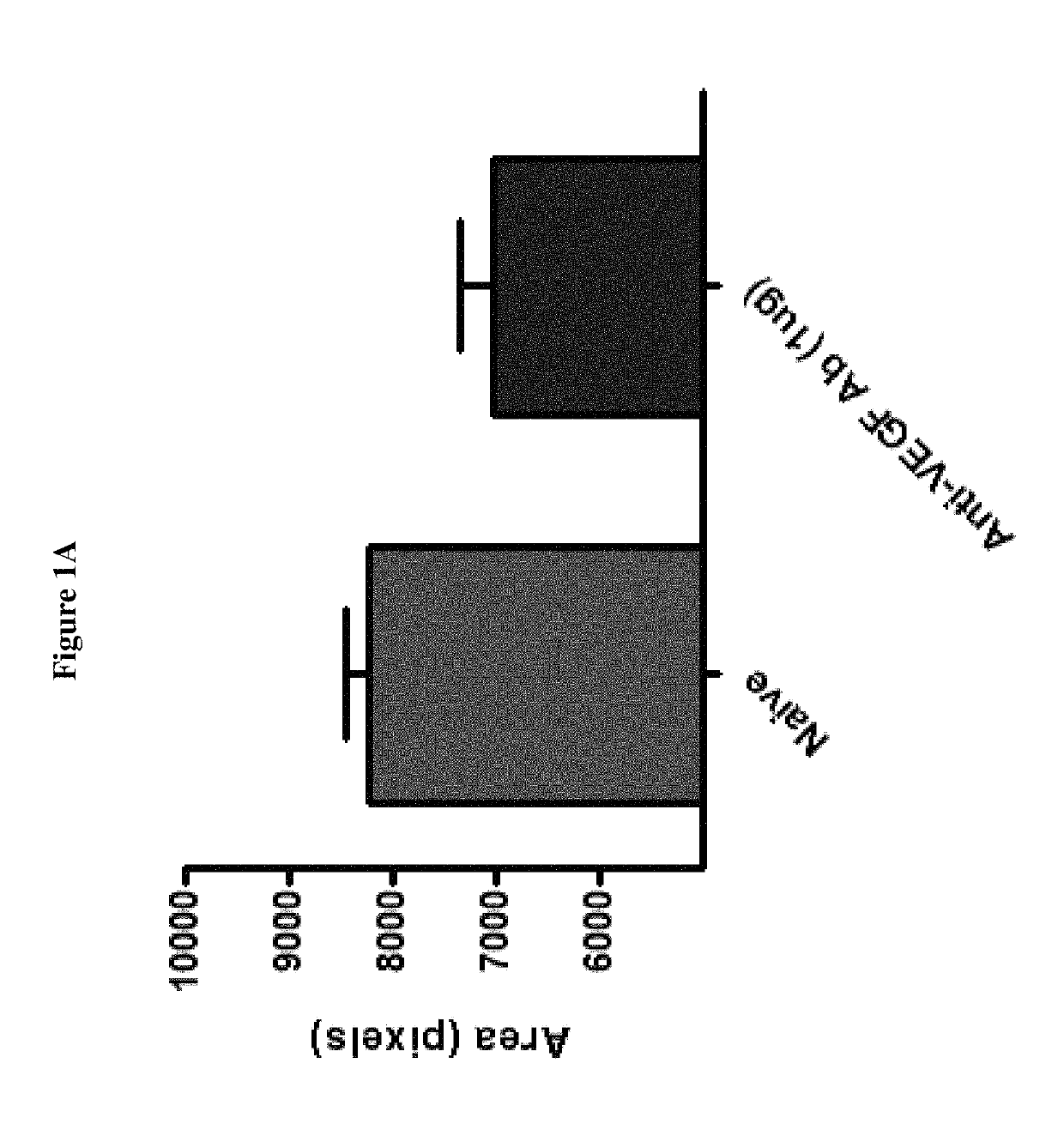 Compositions and methods for treatment of diabetic macular edema