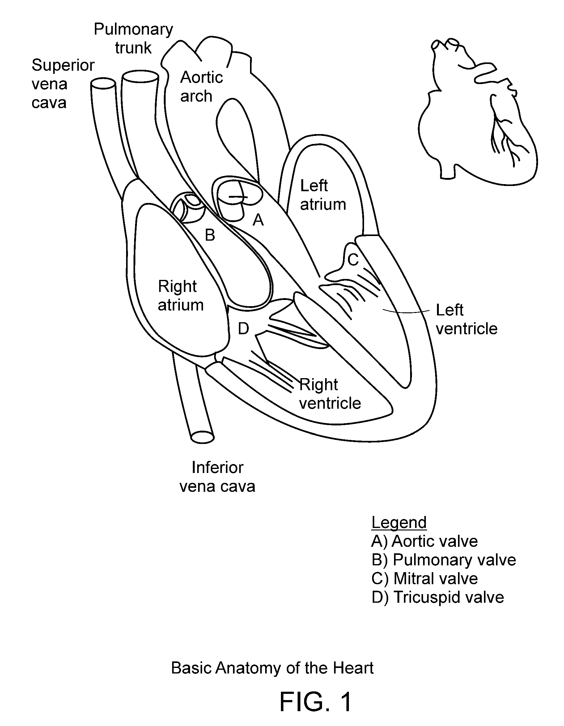 Transcatheter Delivery of a Replacement Heart Valve