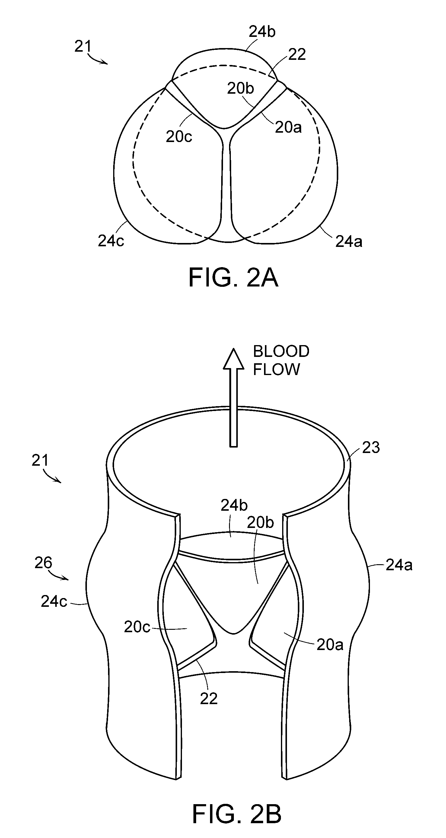 Transcatheter Delivery of a Replacement Heart Valve
