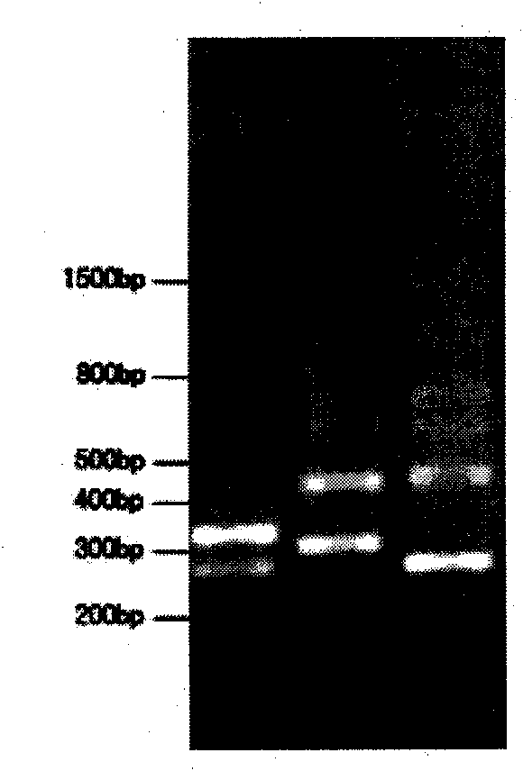 Primer for detecting dynamic mutation of CAG repetitive sequence of ATXN3 gene and PCR amplification method thereof