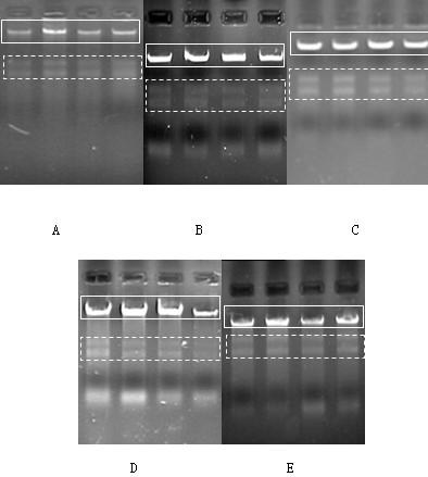 Extraction method of soil microbe genome DNA and total RNA