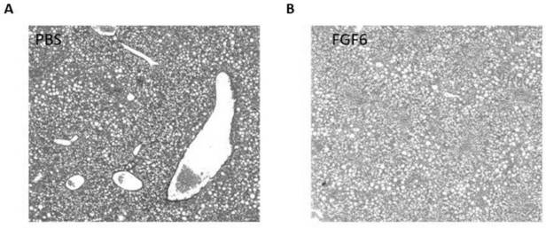Application of fibroblast growth factor 6 in medicine for relieving non-alcoholic steatohepatitis liver injury