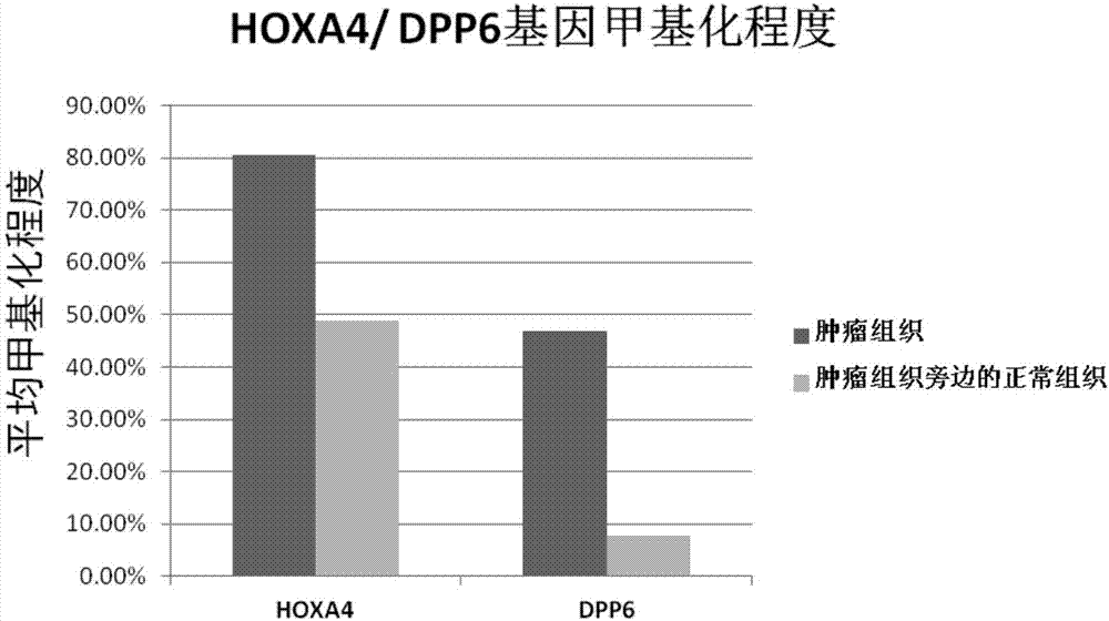 Kit for diagnosis and assessment of breast cancer, and detection and applications of methylated HOXA4/DPP6 gene
