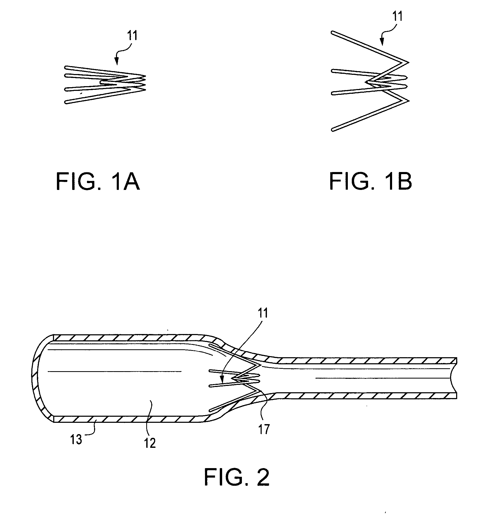 Methods and devices for occluding body lumens and/or enhancing tissue ingrowth