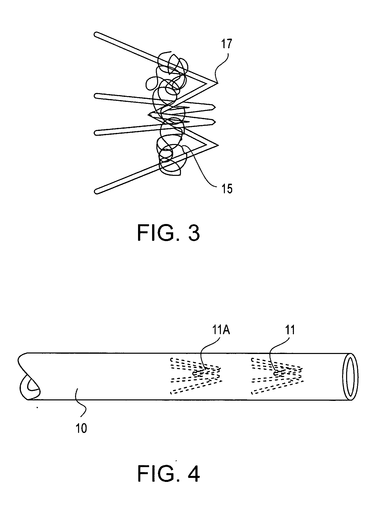 Methods and devices for occluding body lumens and/or enhancing tissue ingrowth