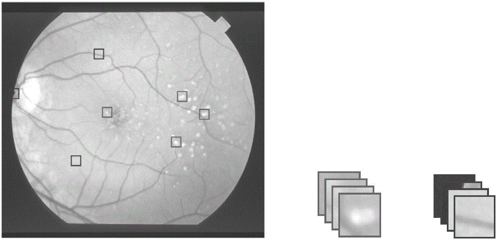 Classification model construction method and device used for macula degeneration region segmentation