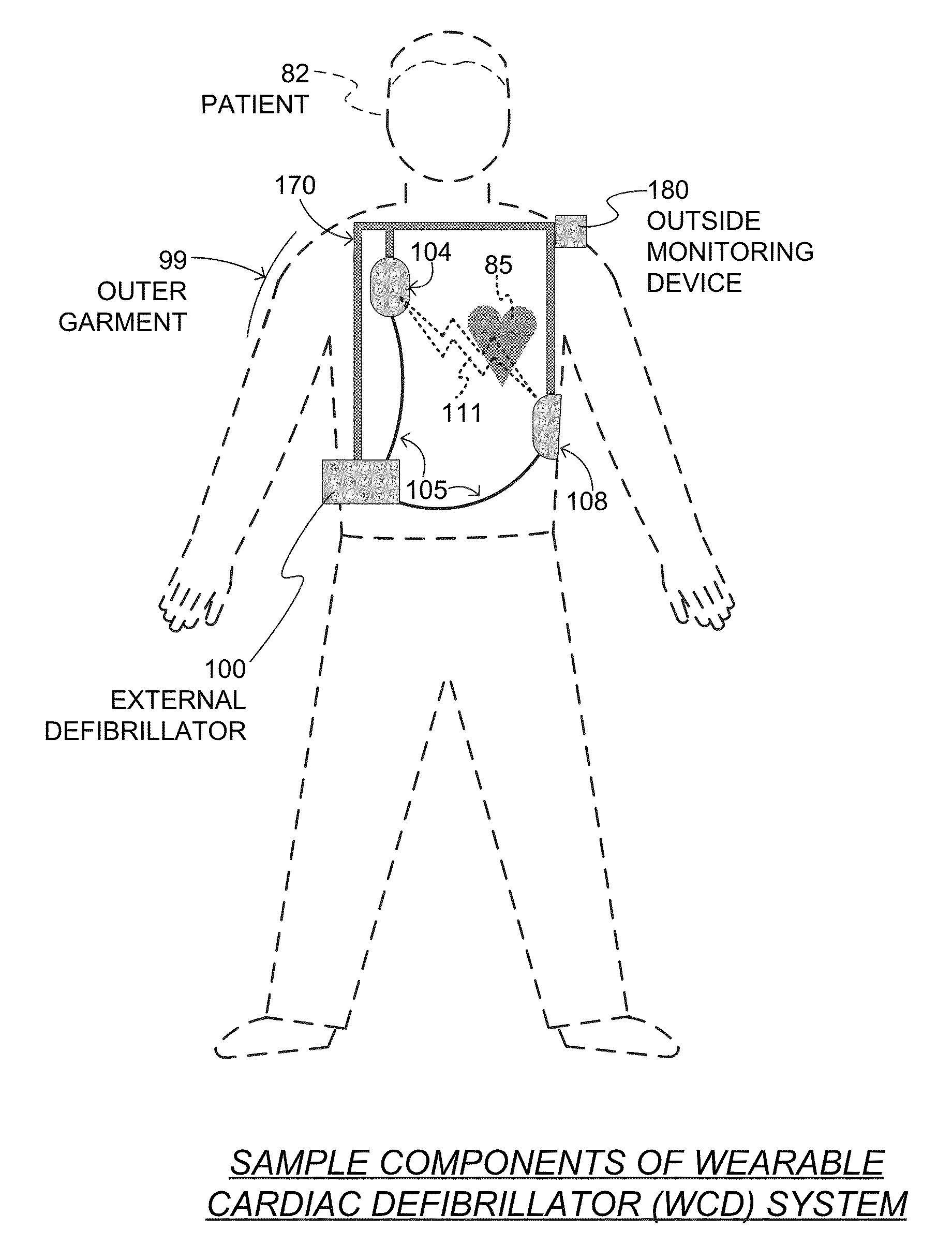 Wearable cardiac defibrillator system emitting CPR prompts