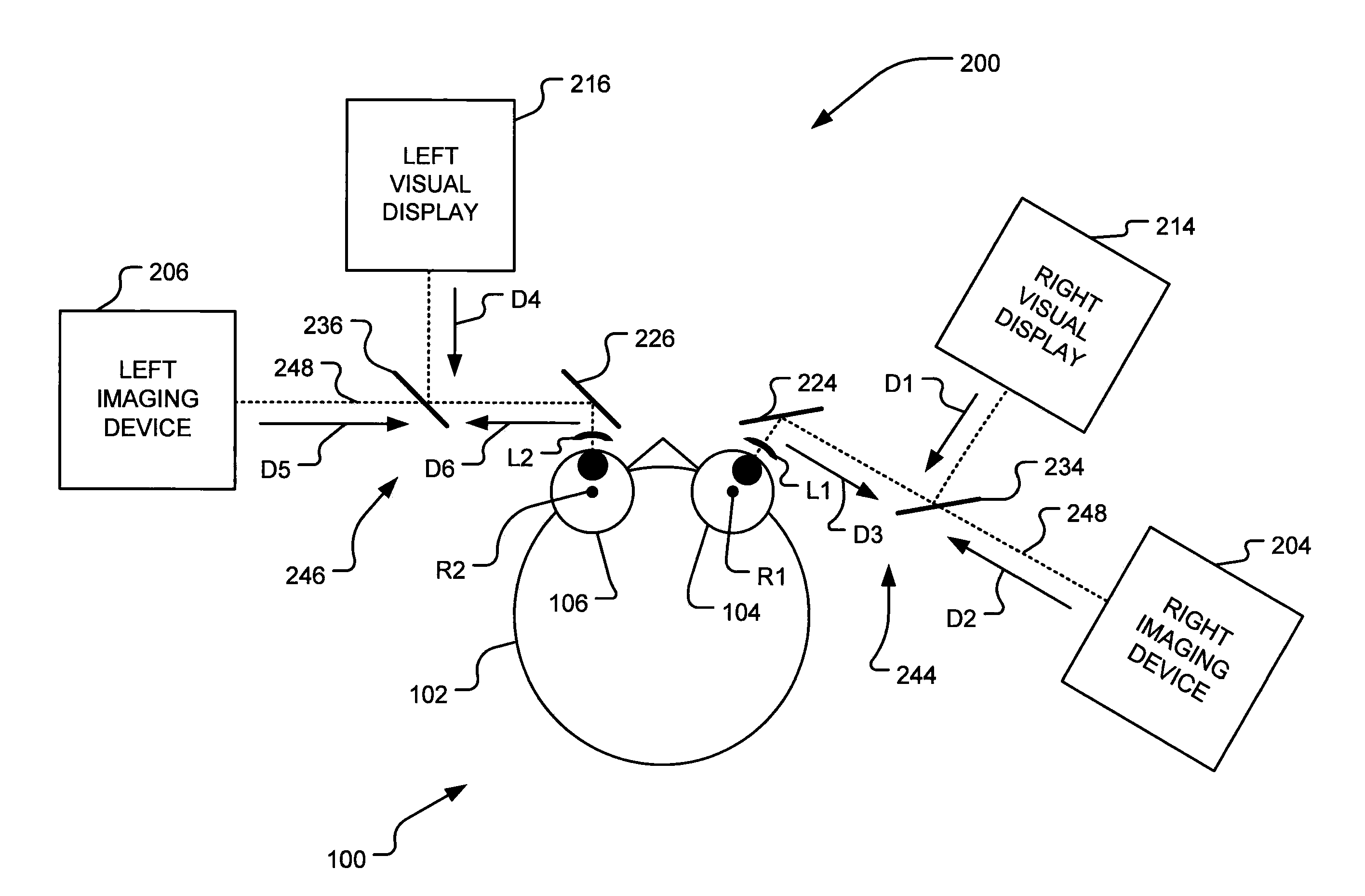 Method and system for treating binocular anomalies