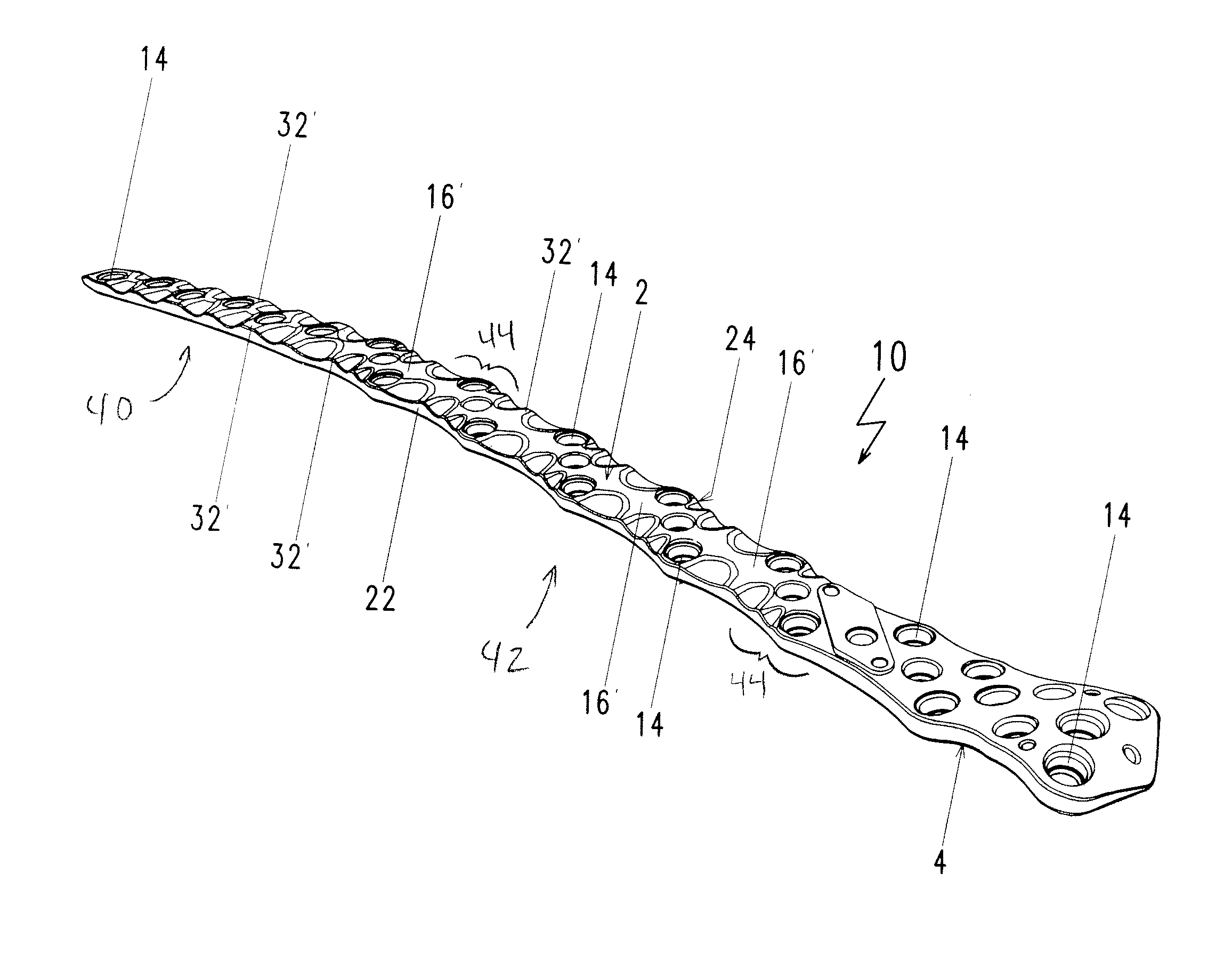 Plate for the treatment of bone fractures
