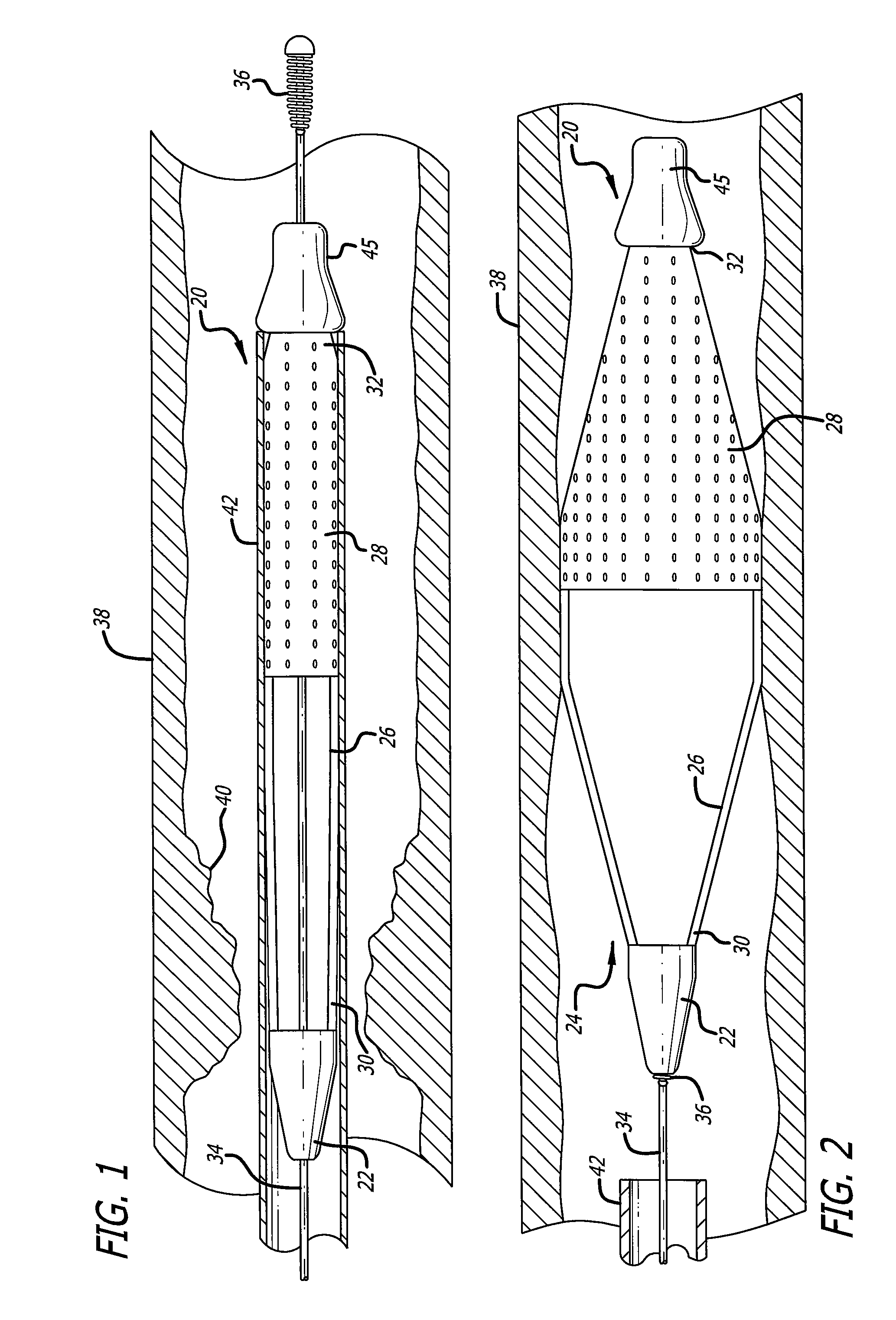 Component for delivering and locking a medical device to a guide wire