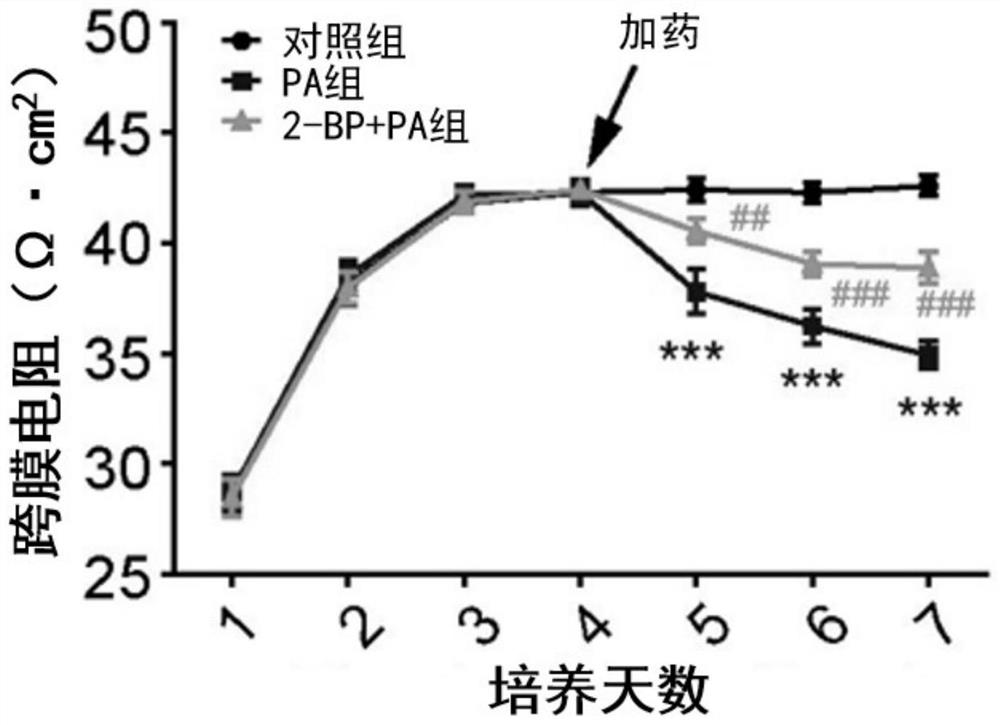 Application of 2-bromopalmitic acid in preparation of medicine for treating spermatogenic dysfunction related diseases