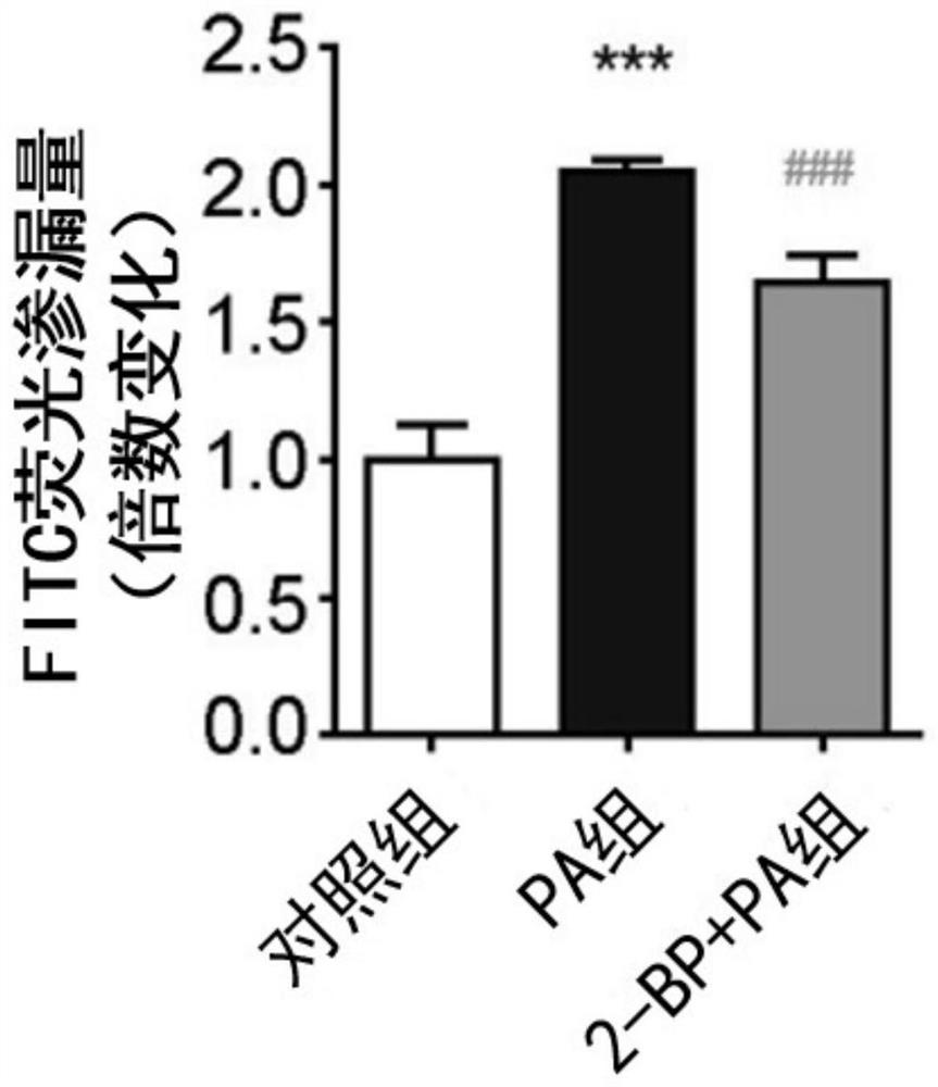 Application of 2-bromopalmitic acid in preparation of medicine for treating spermatogenic dysfunction related diseases