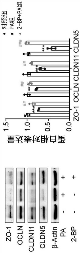Application of 2-bromopalmitic acid in preparation of medicine for treating spermatogenic dysfunction related diseases