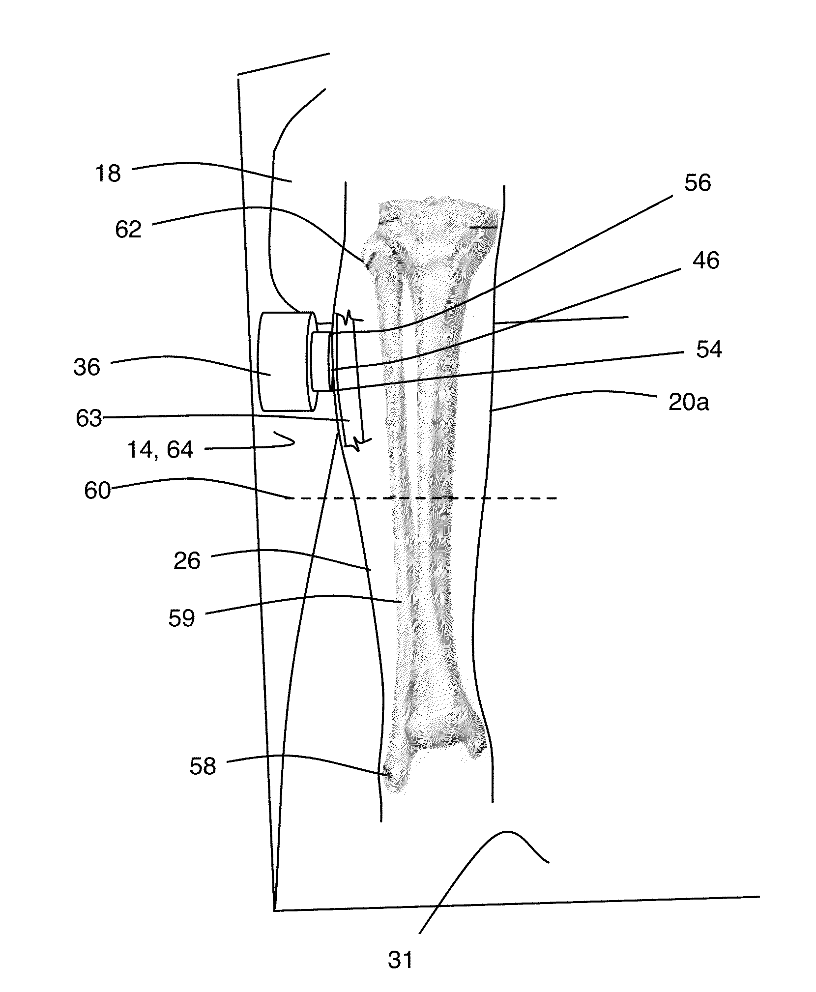 Leg support for vehicle occupant