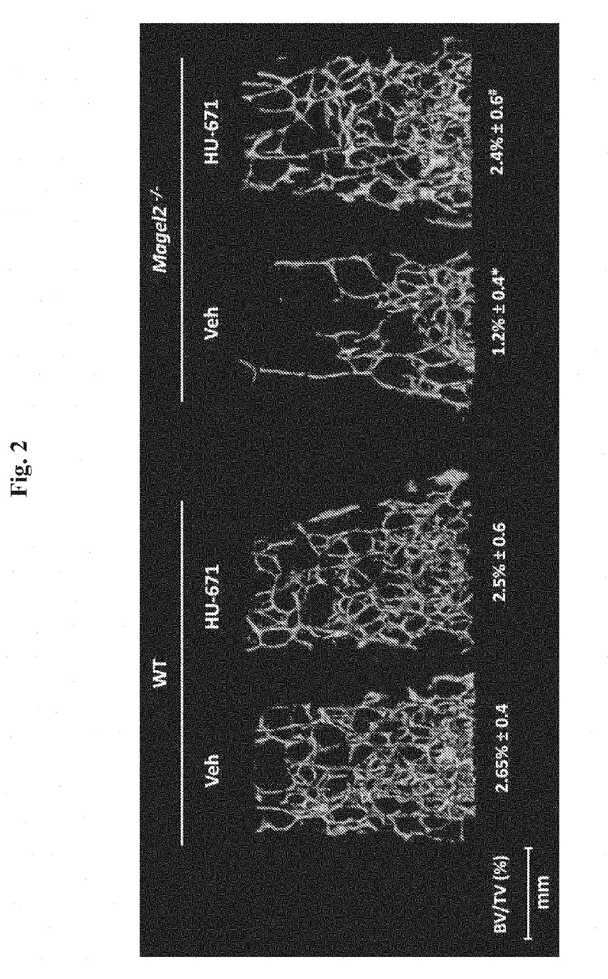 Methods for treatment of prader-willi syndrome