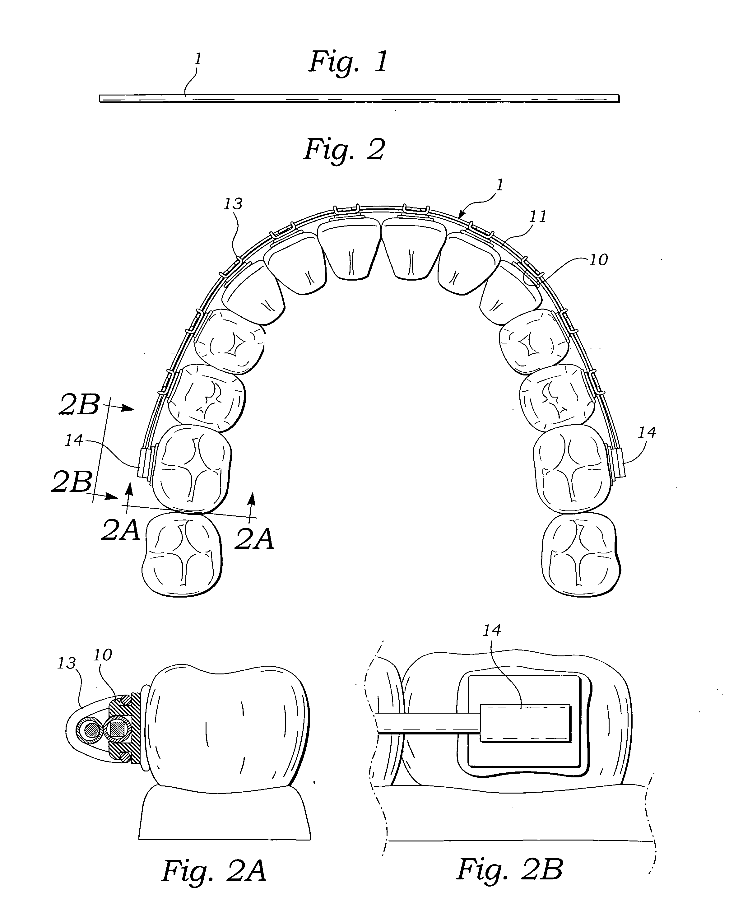 Orthodontic accessory arch bar