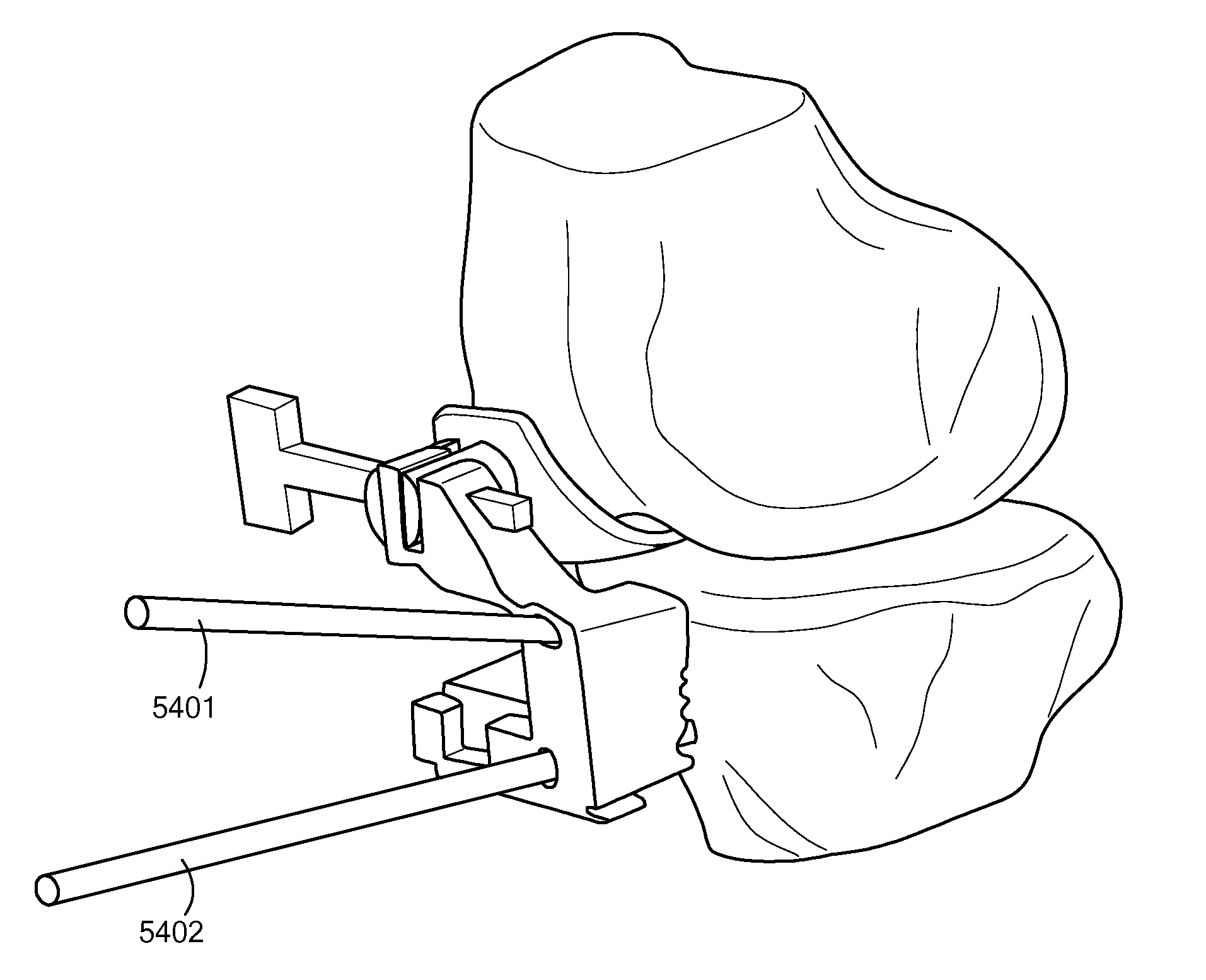 Patient Selectable Joint Arthroplasty Devices and Surgical Tools