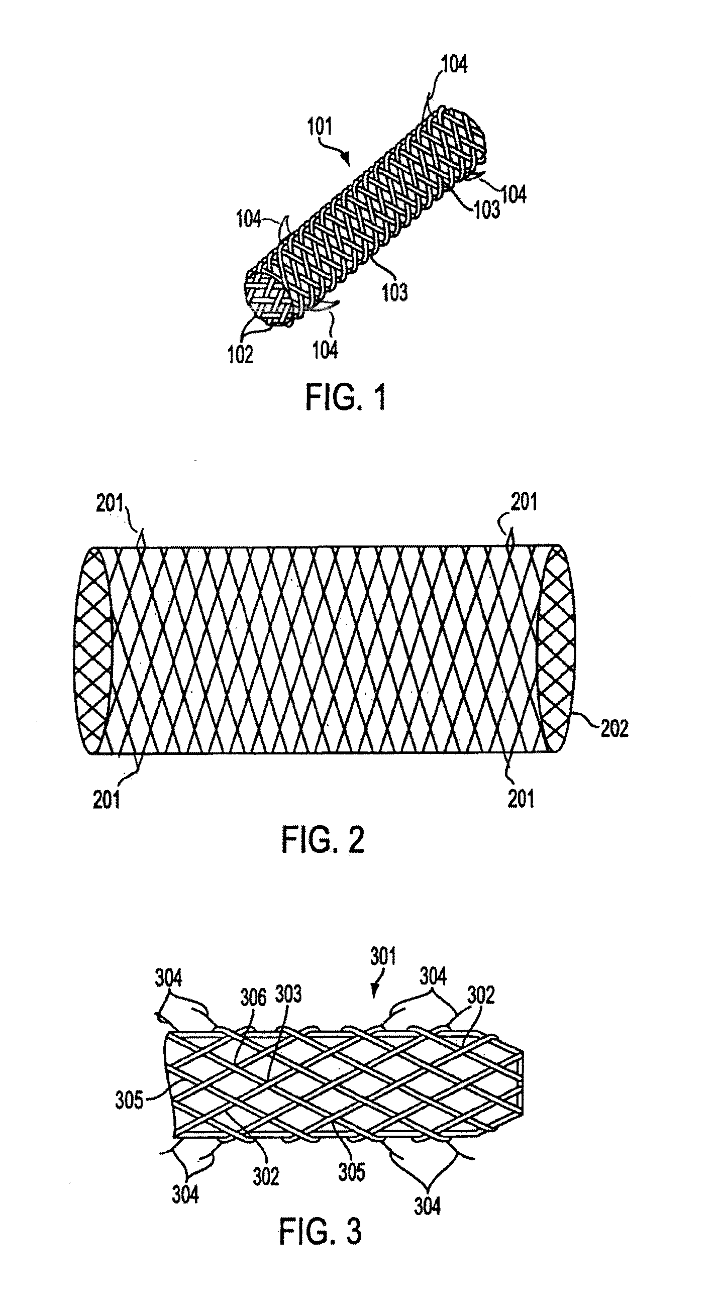 Covered stents with degradable barbs