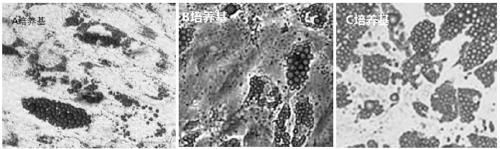 Human umbilical cord mesenchymal stem cell serum-free medium