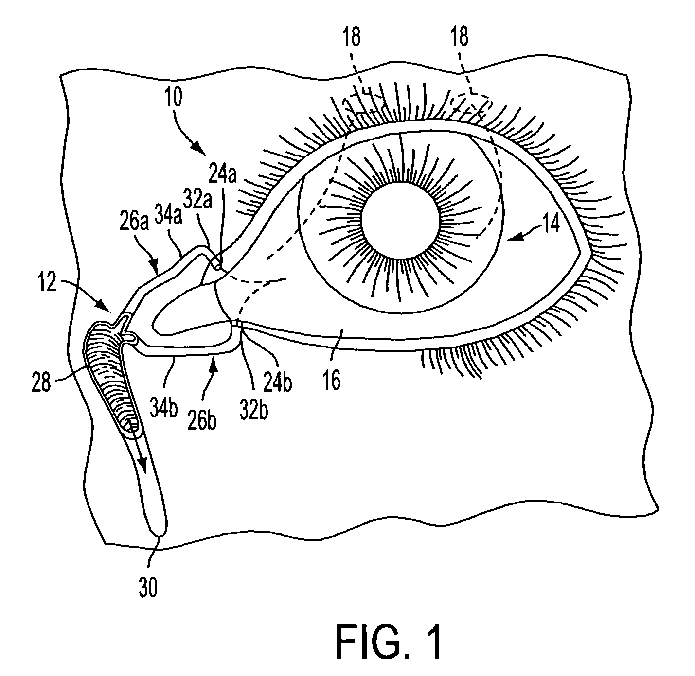 Punctum plugs having fluid collecting recesses and methods of punctal occlusion