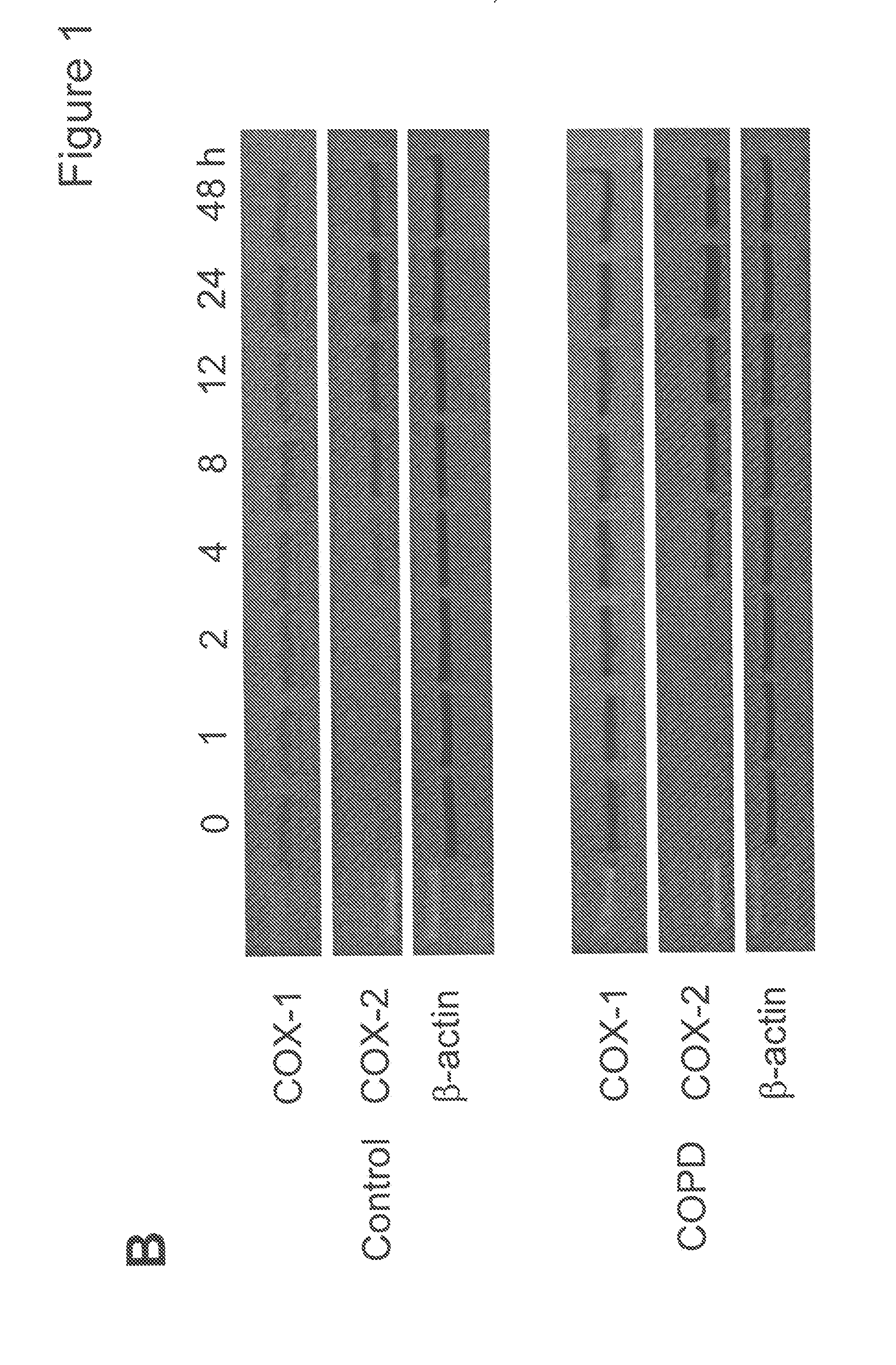 Compositions and Methods for the Diagnosis and Treatment of Inflammatory Disorders and Fibrotic Disease
