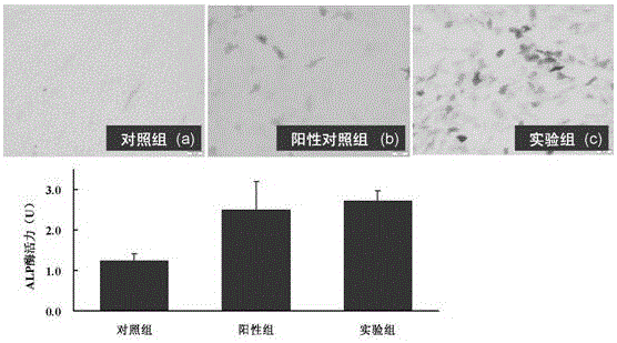 Method for improving osteogenic differentiation efficiency of human amniotic mesenchymal stem cells and application thereof