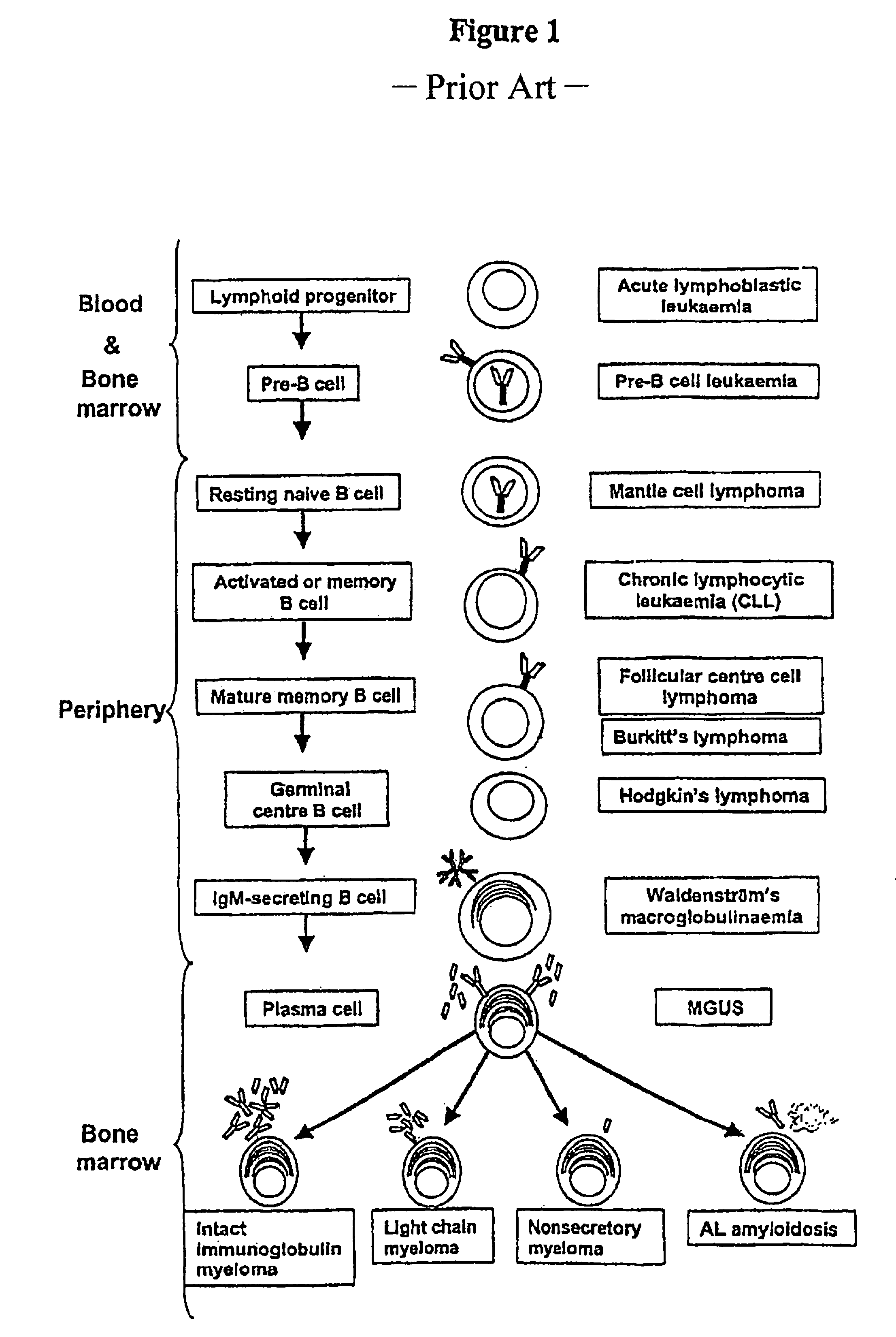 Method of removing antibody free light chains from blood