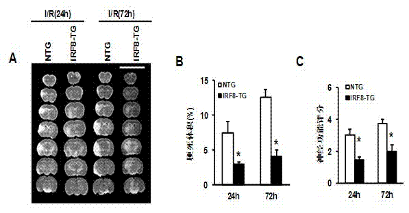 Application of interferon regulatory factor 8 (IRF8) in cerebral apoplexy disease