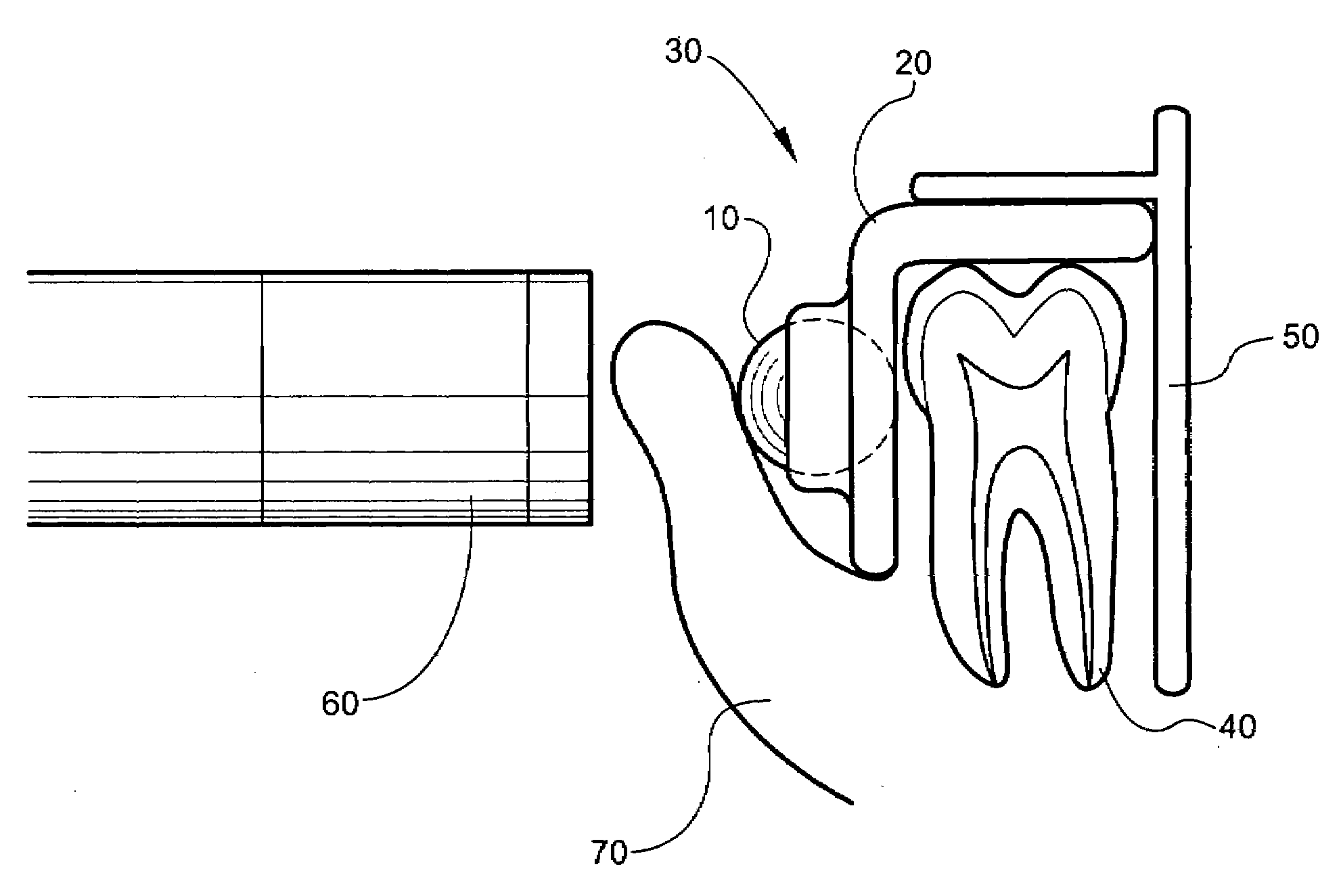 X-ray reference device and method of use