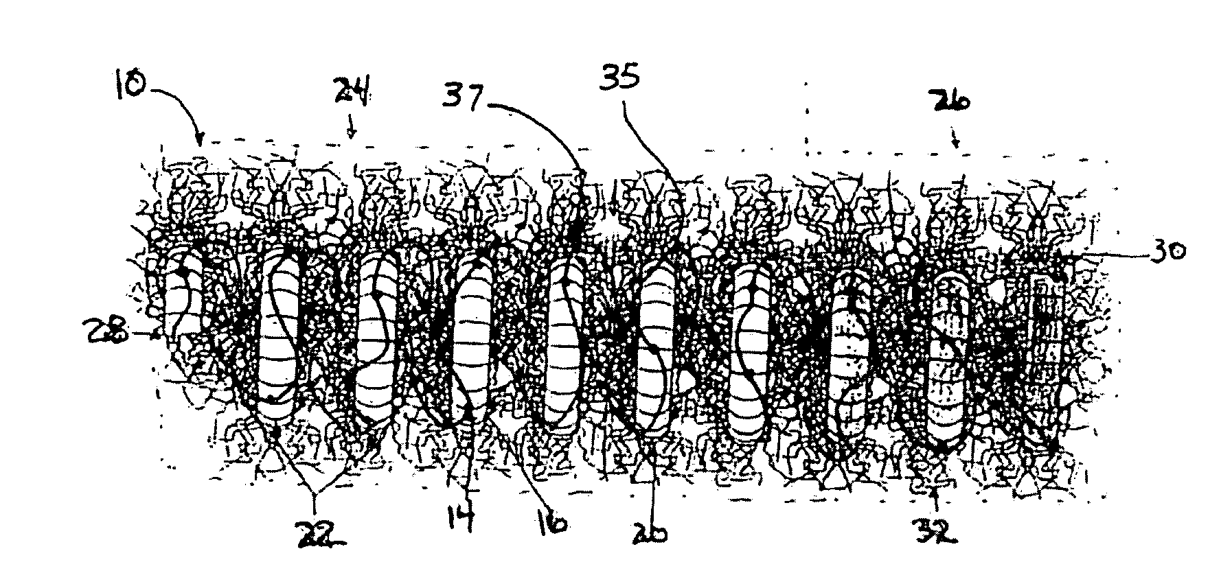 Spiral occluding device with an occlusion sail