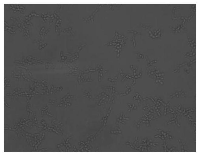 Lactobacillus rhamnosus, fermentation lysate for regulating skin micro-ecology, preparation method and application of lactobacillus rhamnosus and fermentation lysate