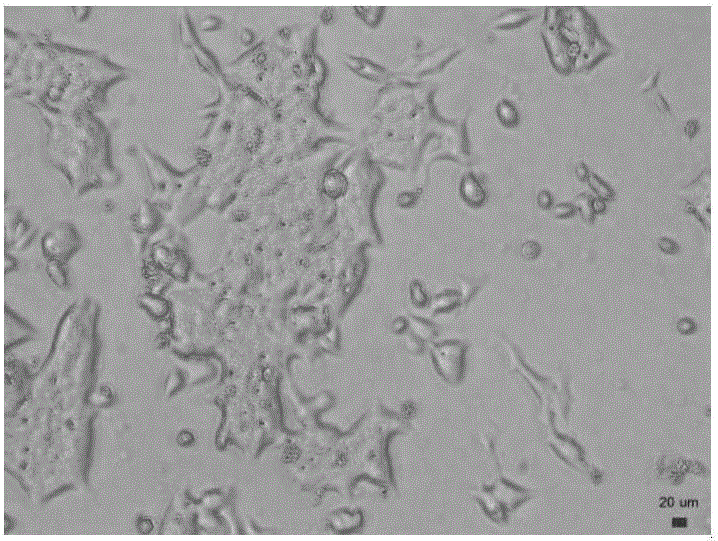 Cell line sourced from later-stage gastric signet ring cell cancer, and establishing method and application thereof