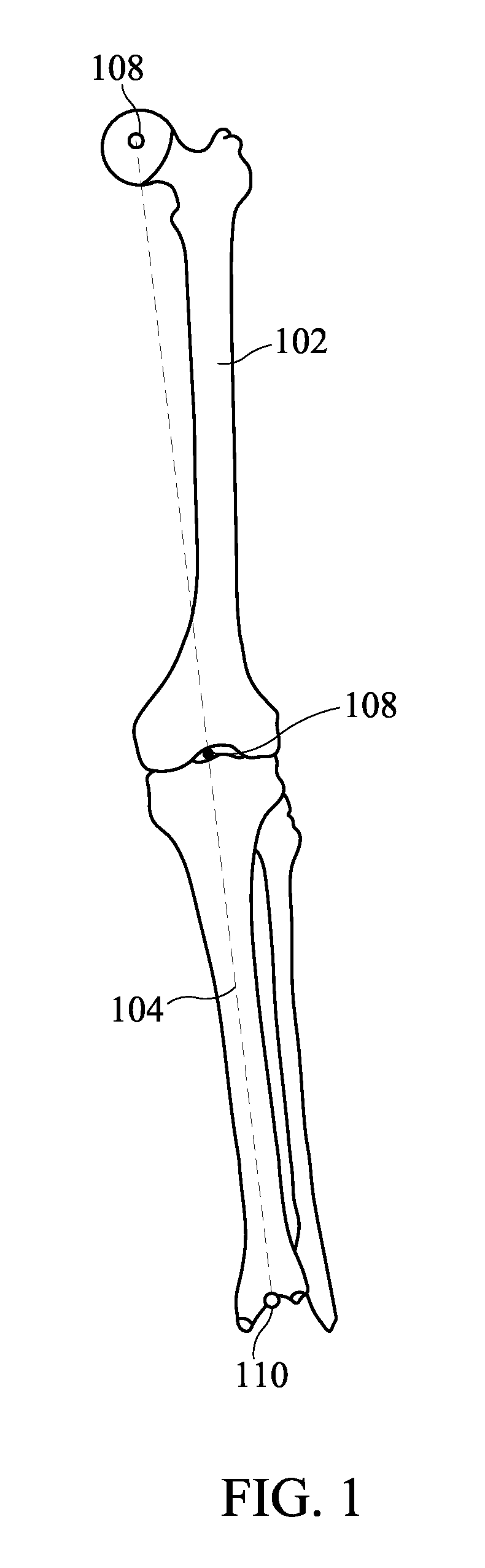 System and Method for Orthopedic Alignment and Measurement