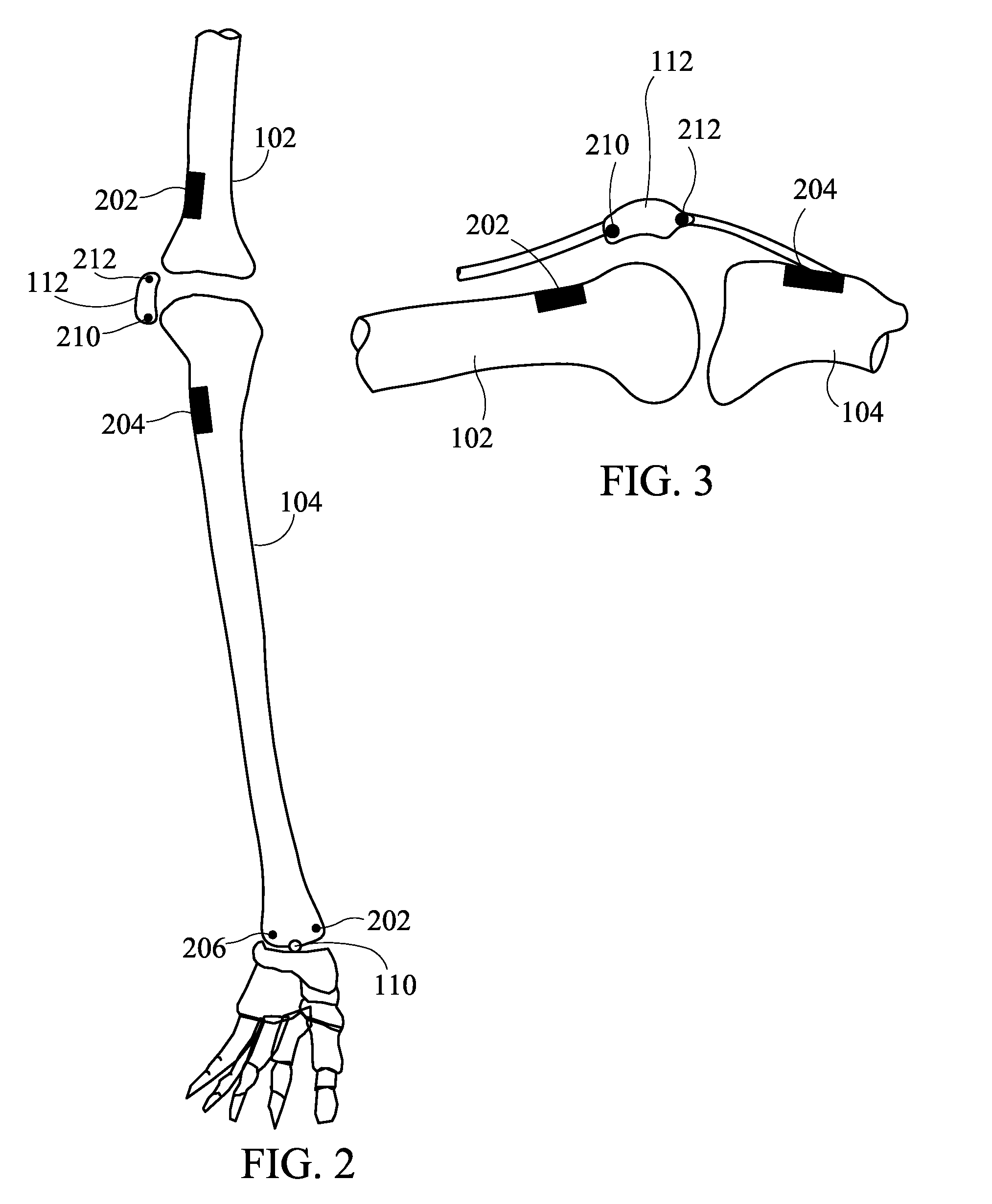 System and Method for Orthopedic Alignment and Measurement