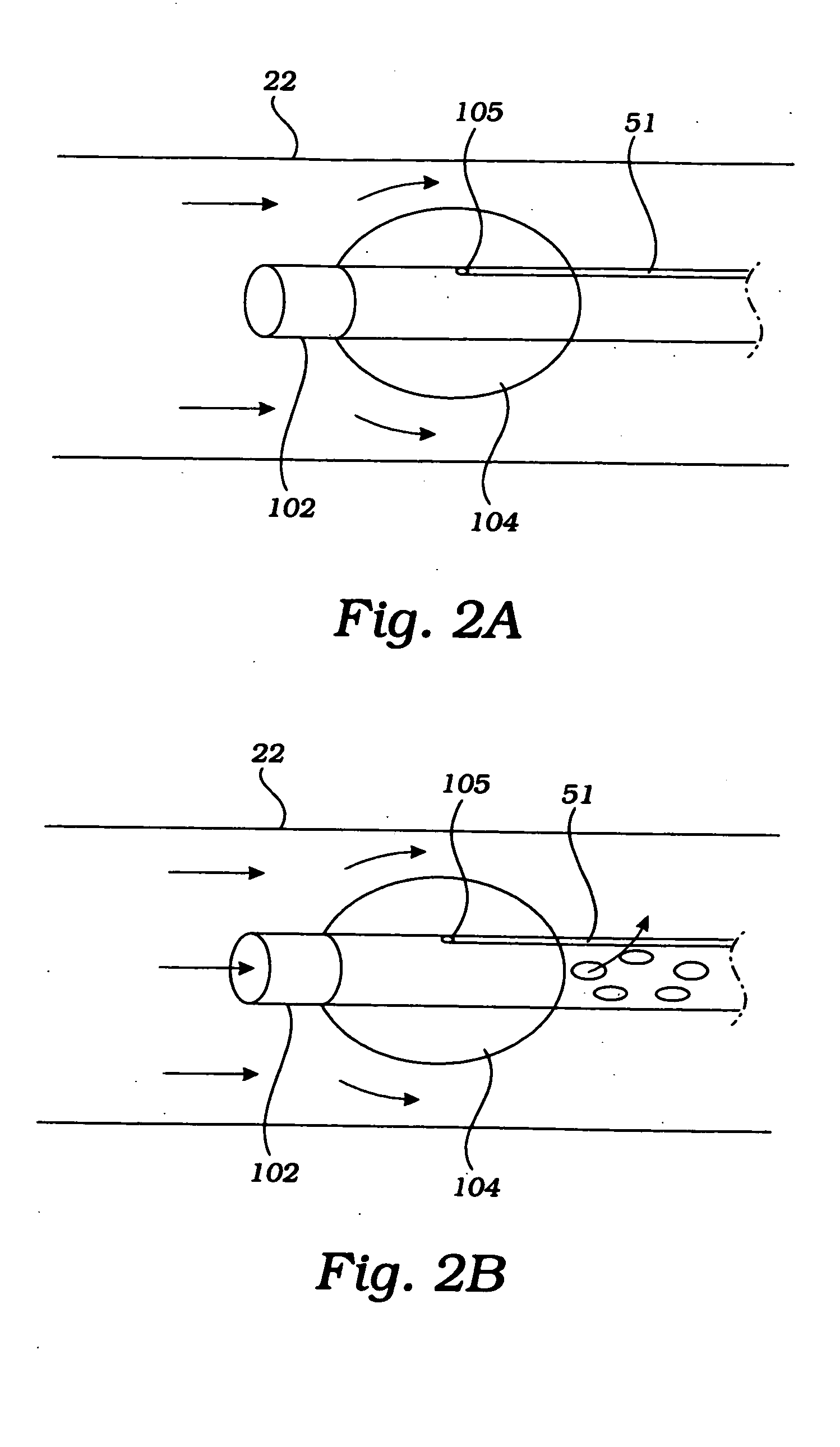 Partial aortic occlusion devices and methods for cerebral perfusion augmentation