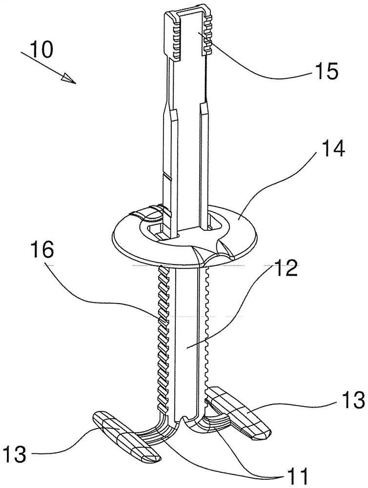 Device for fixing a craniotomy operculum to the cranial vault to be inserted in the craniotomy cut