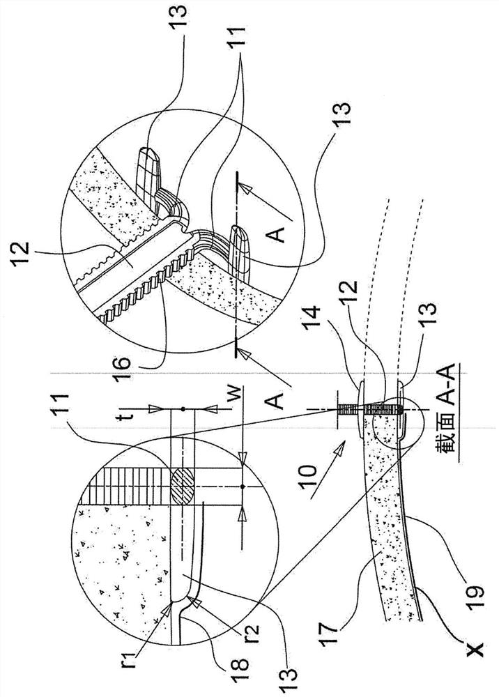 Device for fixing a craniotomy operculum to the cranial vault to be inserted in the craniotomy cut