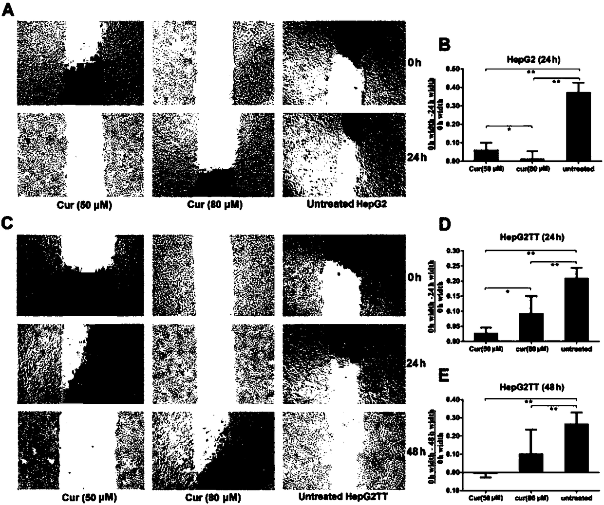 New target using curcumin to inhibit hepatic cancers and application