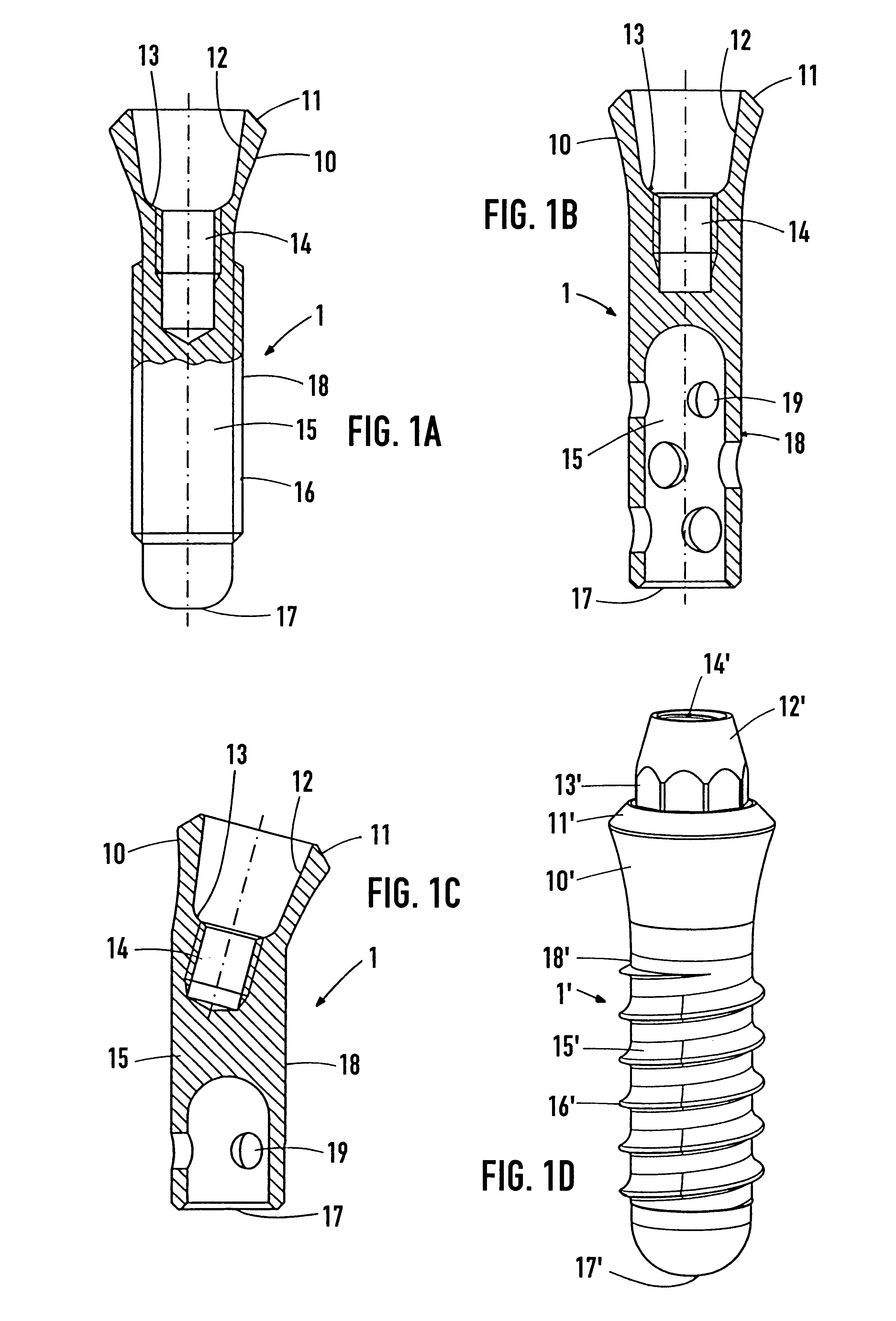 Retaining element for an implant and ampoule for preserving said implant