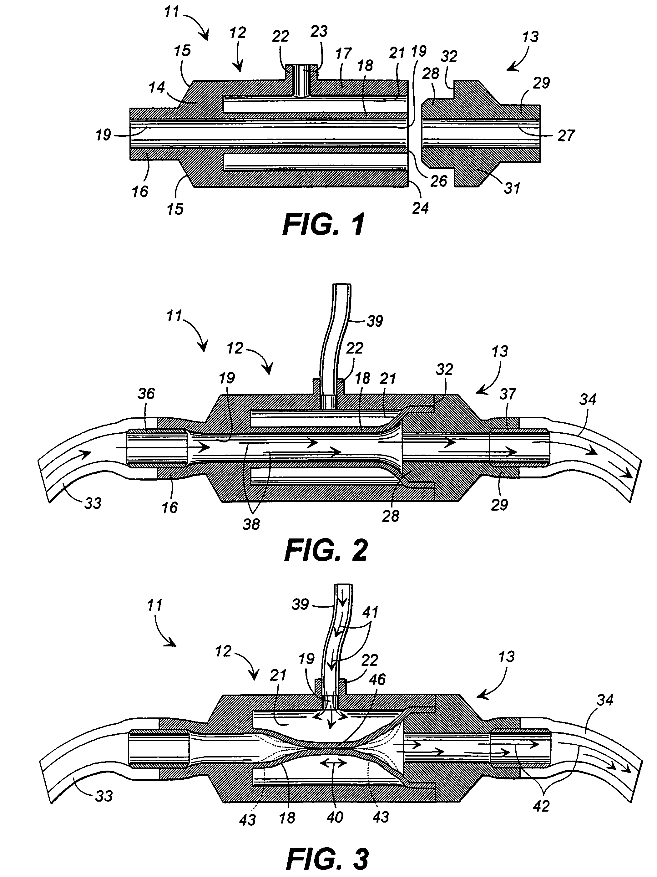 Method and apparatus for delivering a colonic lavage