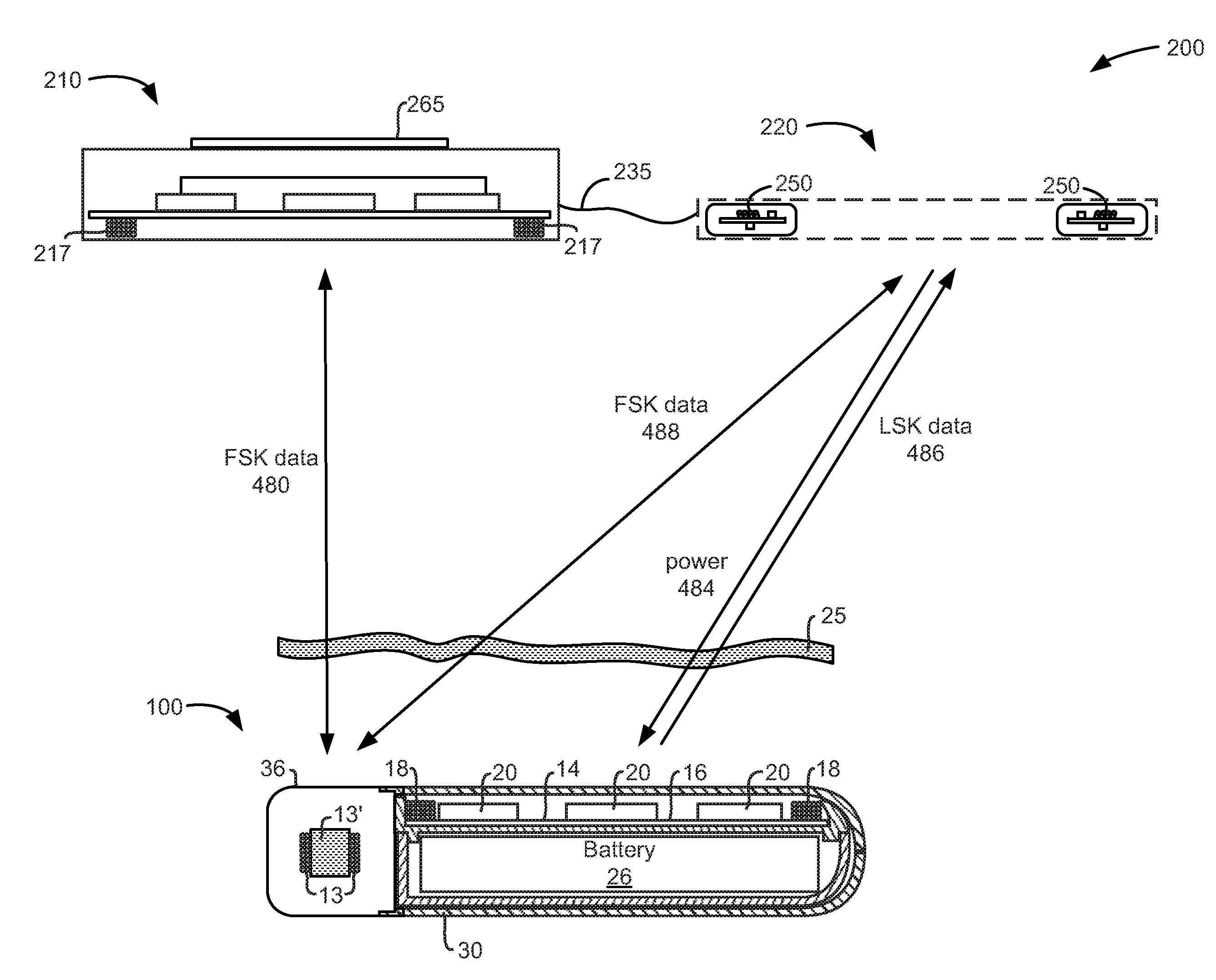External Controller/Charger System for an Implantable Medical Device Capable of Automatically Providing Data Telemetry Through a Charging Coil During a Charging Session